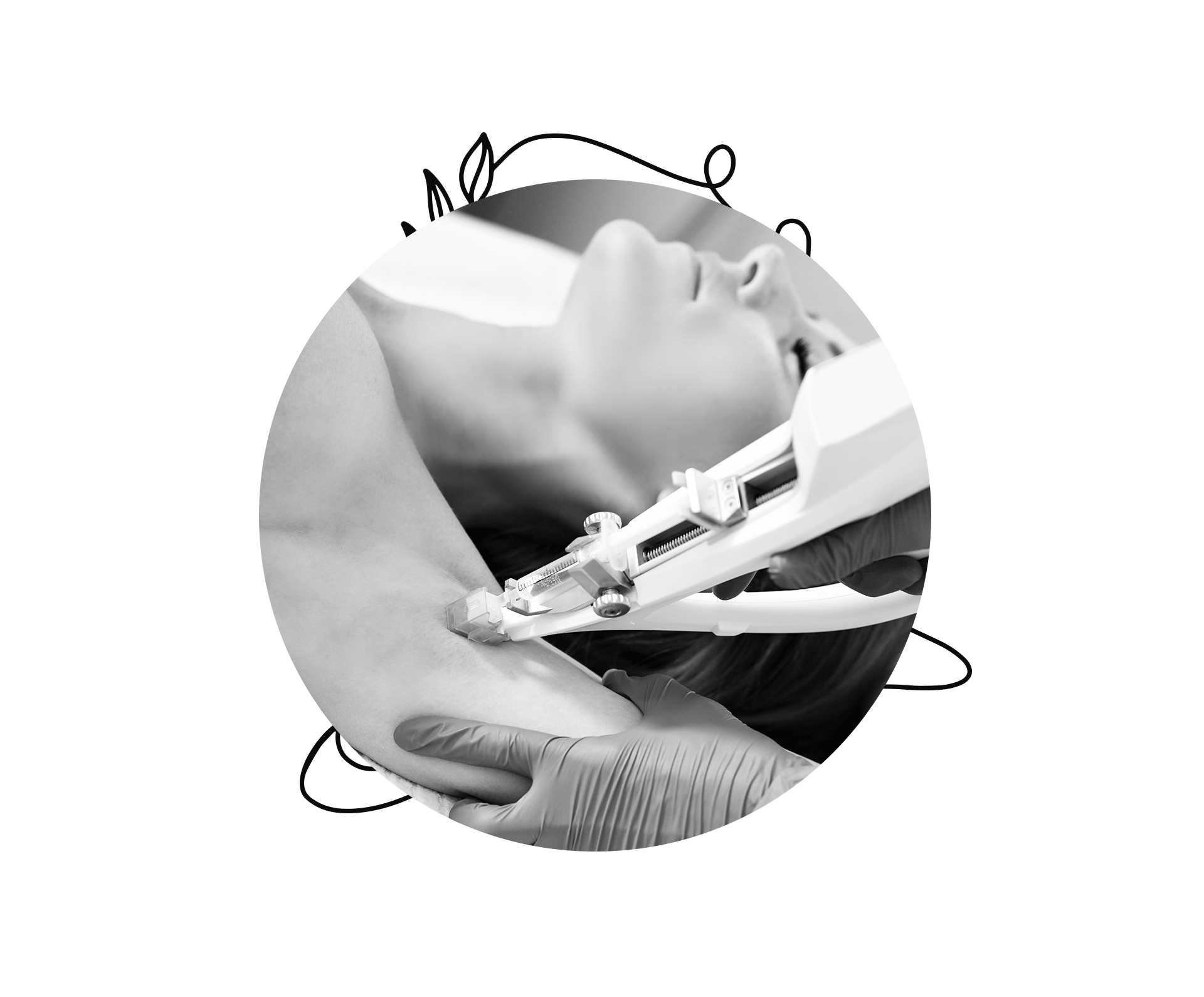 BOTOx-FOR-SWEATING-1 (2)