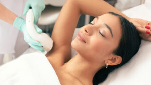 laser hair removal procedure