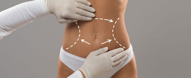 body contouring woman body