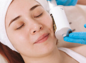 endosphere facial treatment