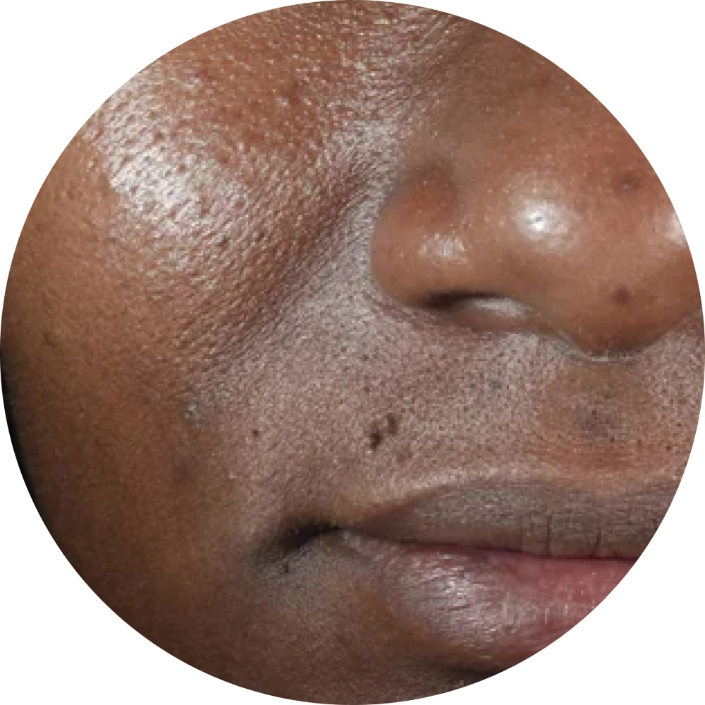 Diamond Glow - After