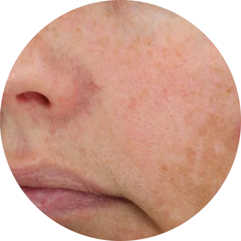 Diamond Glow - Before