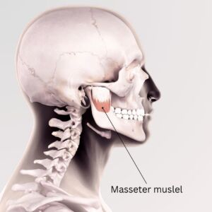 Masseter musle Masseter musle