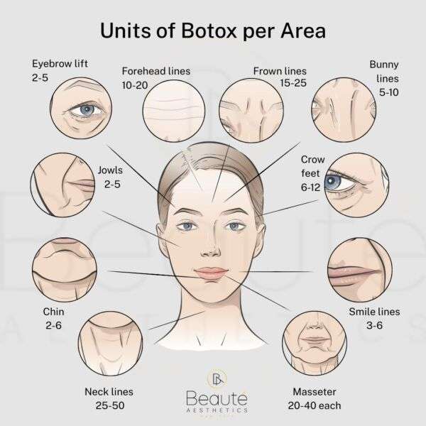Units of Botox per Area Units of Botox per Area