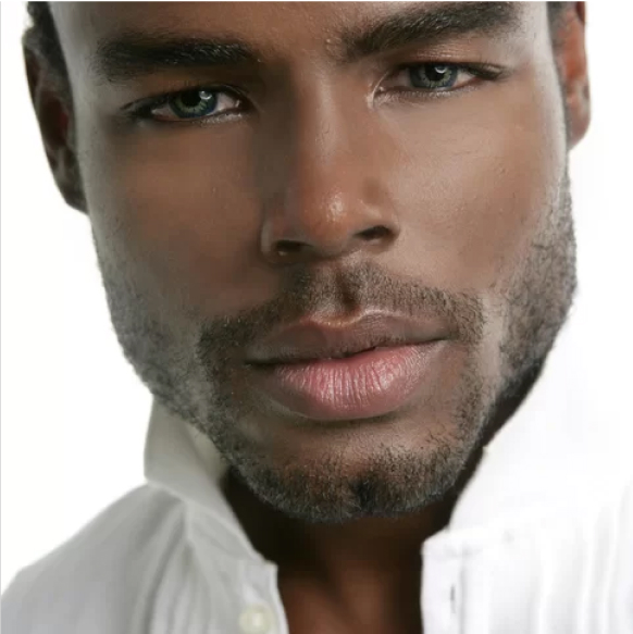 Dermal Fillers