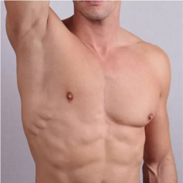 Laser Hair Removal 