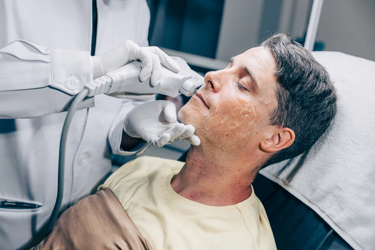 What Is Morpheus8 Treatment and What Can It Do for My Skin